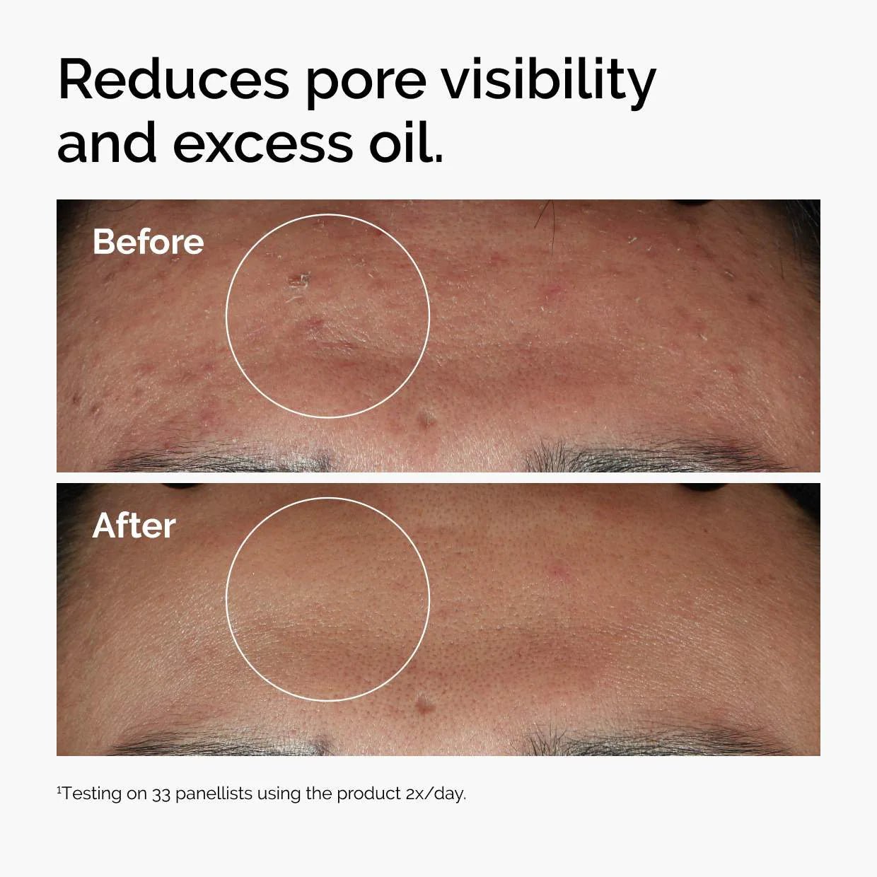Niacinamide 10% + Zinc 1% Serum for Oily Skin - Hidden Jewels Co.