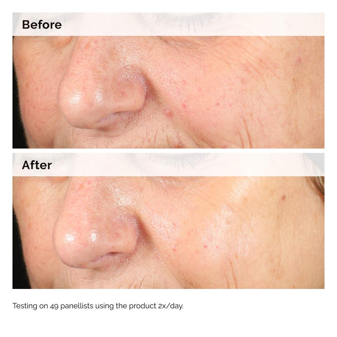 Alpha Arbutin 2% + Hyaluronic Acid for Hyperpigmentation - Hidden Jewels Co.