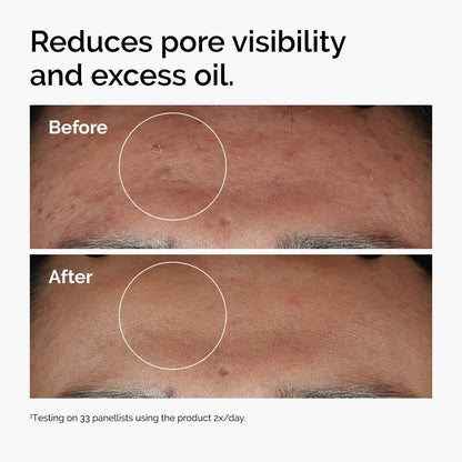 Niacinamide 10% + Zinc 1% Serum for Oily Skin - Hidden Jewels Co.